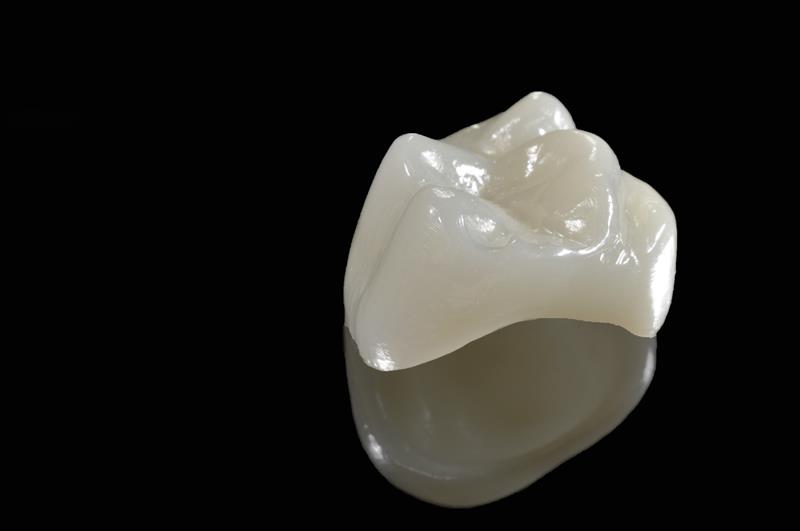 Porcelain Crowns  Waynesboro, MS 